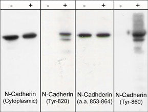 Phospho-N-cadherin/E-cadherin (Tyr820, Tyr835, Tyr860) Antibody in Western Blot (WB)