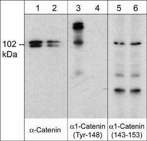 Phospho-Catenin alpha-1 (Tyr148) Antibody in Western Blot (WB)