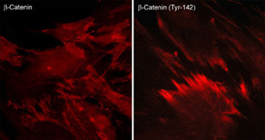 Phospho-beta Catenin/gamma Catenin (Tyr142, Tyr133) Antibody in Immunocytochemistry (ICC/IF)