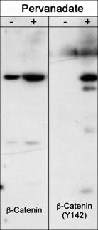 Phospho-beta Catenin/gamma Catenin (Tyr142, Tyr133) Antibody in Western Blot (WB)