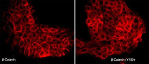 Phospho-beta Catenin/gamma Catenin (Tyr489, Tyr480) Antibody in Immunocytochemistry (ICC/IF)