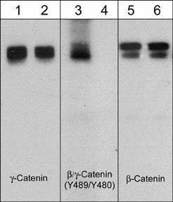 Phospho-beta Catenin/gamma Catenin (Tyr489, Tyr480) Antibody in Western Blot (WB)