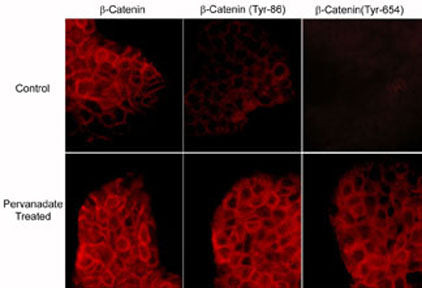 Phospho-beta Catenin/gamma Catenin (Tyr654, Tyr644) Antibody in Immunocytochemistry (ICC/IF)