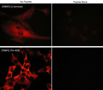 Phospho-CRMP2 (Thr555) Antibody in Immunocytochemistry (ICC/IF)