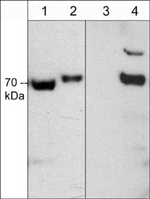 Phospho-CRMP2 (Thr555) Antibody in Western Blot (WB)