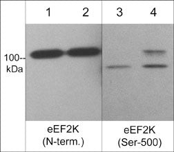 Phospho-EEF2K (Ser500) Antibody in Western Blot (WB)