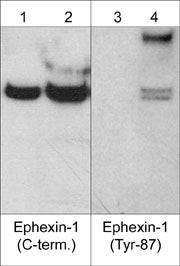 Phospho-NGEF (Tyr87) Antibody in Western Blot (WB)