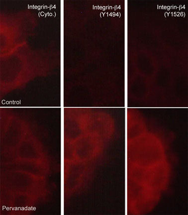 Phospho-CD104 Integrin beta 4 (Tyr1526) Antibody in Immunocytochemistry (ICC/IF)