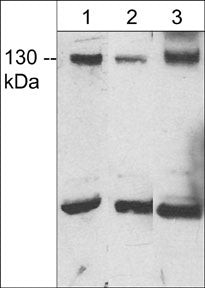 JMY Antibody in Western Blot (WB)