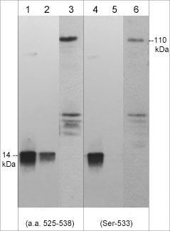 Phospho-NLRC4 (Ser533) Antibody in Western Blot (WB)