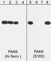 Phospho-PAK6 (Ser165) Antibody in Western Blot (WB)