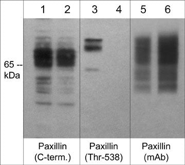 Phospho-Paxillin (Thr538) Antibody in Western Blot (WB)