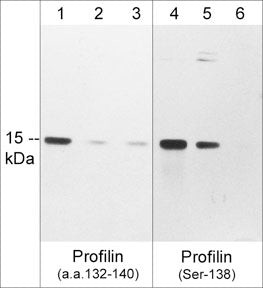 Phospho-Profilin 1 (Ser138) Antibody in Western Blot (WB)