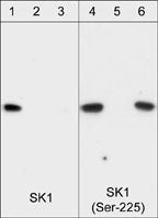 Phospho-SPHK1 (Ser225) Antibody in Western Blot (WB)