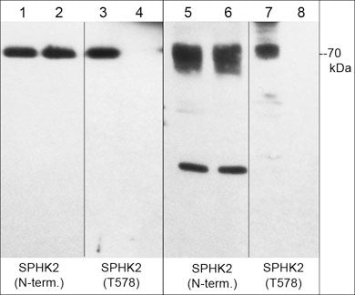 SPHK2 Antibody in Western Blot (WB)