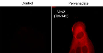 Phospho-VAV2 (Tyr142) Antibody in Immunocytochemistry (ICC/IF)