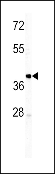 Human IgM Secondary Antibody in Western Blot (WB)