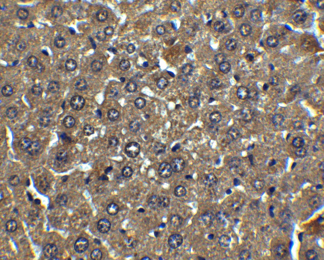 Albumin Antibody in Immunohistochemistry (Paraffin) (IHC (P))