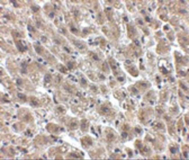 Albumin Antibody in Immunohistochemistry (Paraffin) (IHC (P))