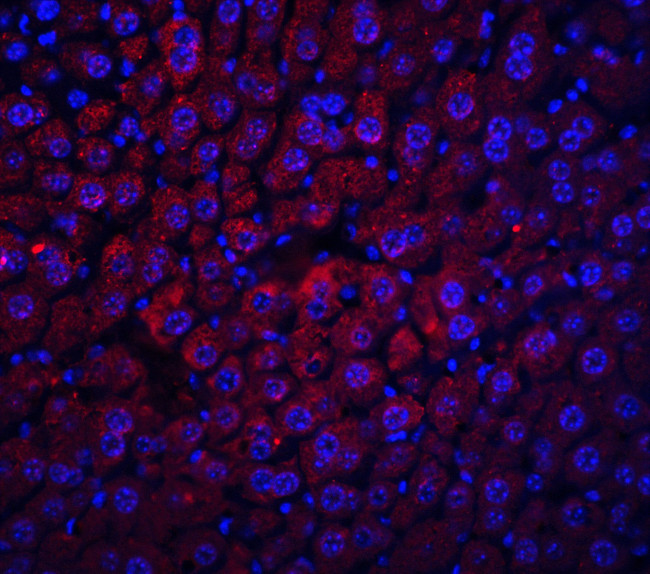 Albumin Antibody in Immunohistochemistry (Paraffin) (IHC (P))