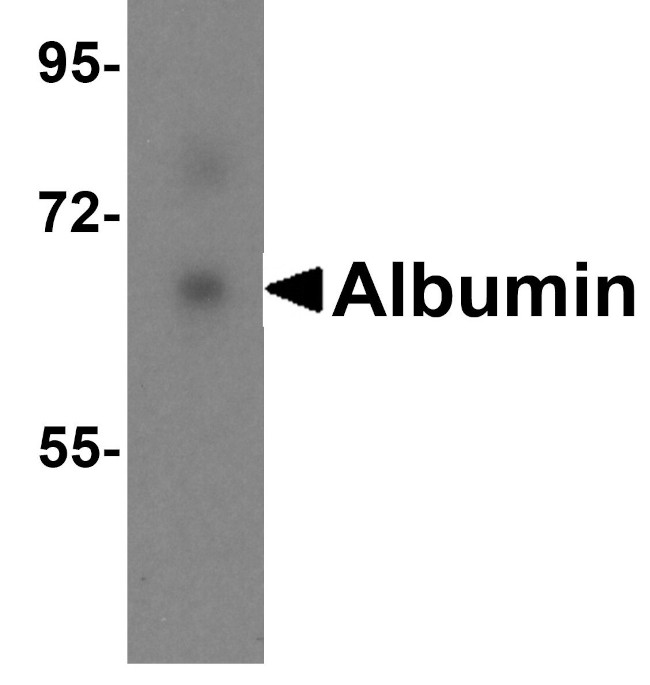 Albumin Antibody in Western Blot (WB)