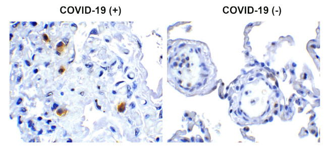 SARS-CoV-2 NSP14 Antibody in Immunohistochemistry (Paraffin) (IHC (P))