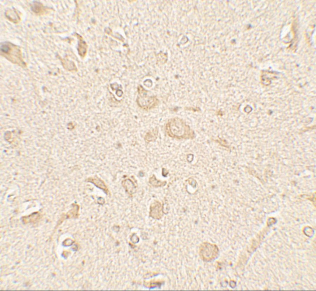 LC3B Antibody in Immunohistochemistry (Paraffin) (IHC (P))