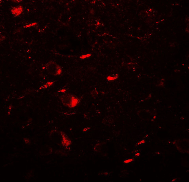 LC3B Antibody in Immunohistochemistry (Paraffin) (IHC (P))