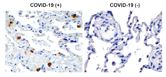 SARS-CoV-2 NSP8 Antibody in Immunohistochemistry (Paraffin) (IHC (P))