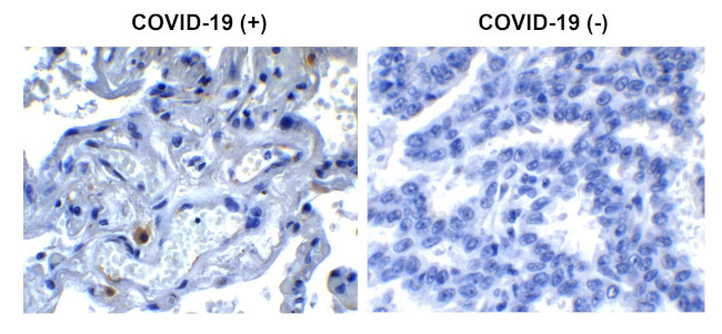 SARS-CoV-2 NSP9 Antibody in Immunohistochemistry (Paraffin) (IHC (P))