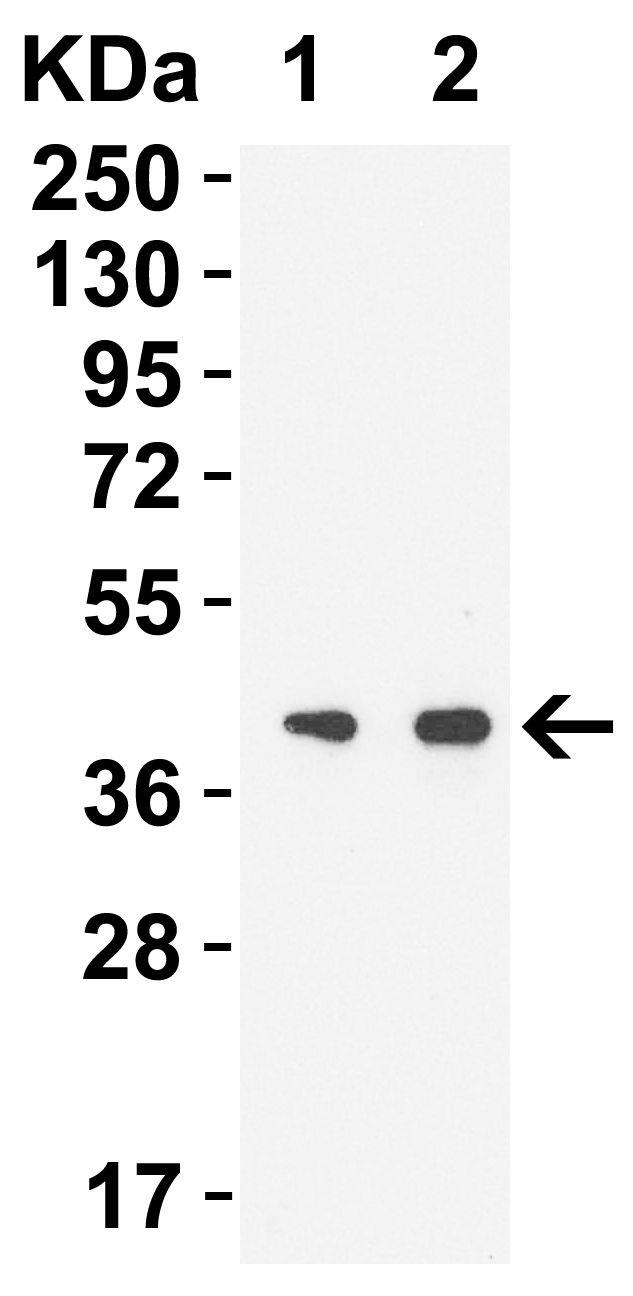 SARS-CoV-2 NSP15 Antibody in Western Blot (WB)