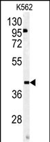 OMD Antibody in Western Blot (WB)