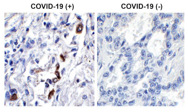 SARS-CoV-2 ORF3a Antibody in Immunohistochemistry (Paraffin) (IHC (P))