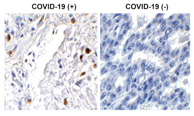 SARS-CoV-2 ORF7a Antibody in Immunohistochemistry (Paraffin) (IHC (P))