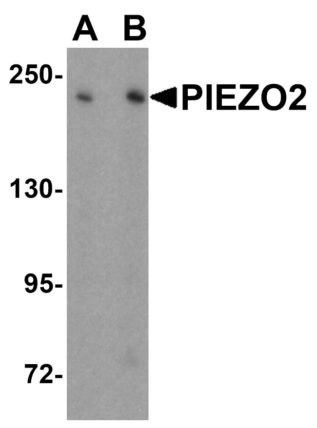 PIEZO2 Antibody in Western Blot (WB)