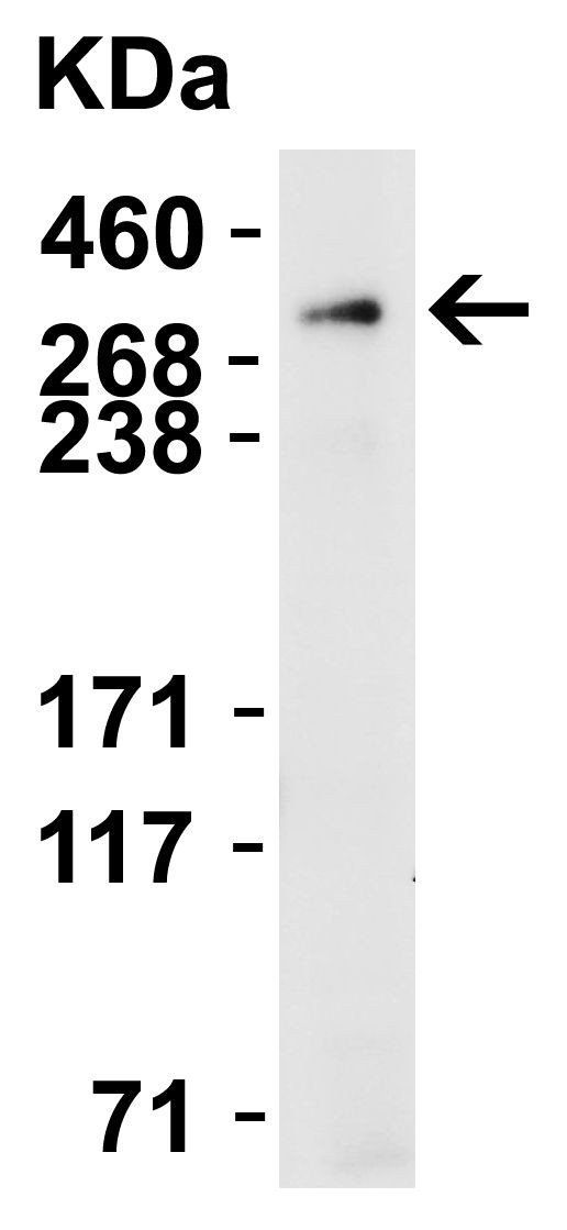 PIEZO2 Antibody in Western Blot (WB)