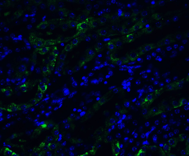 TMPRSS2 Antibody in Immunohistochemistry (PFA fixed) (IHC (PFA))