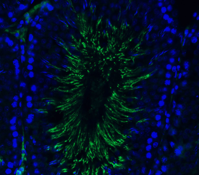 TMPRSS2 Antibody in Immunohistochemistry (PFA fixed) (IHC (PFA))