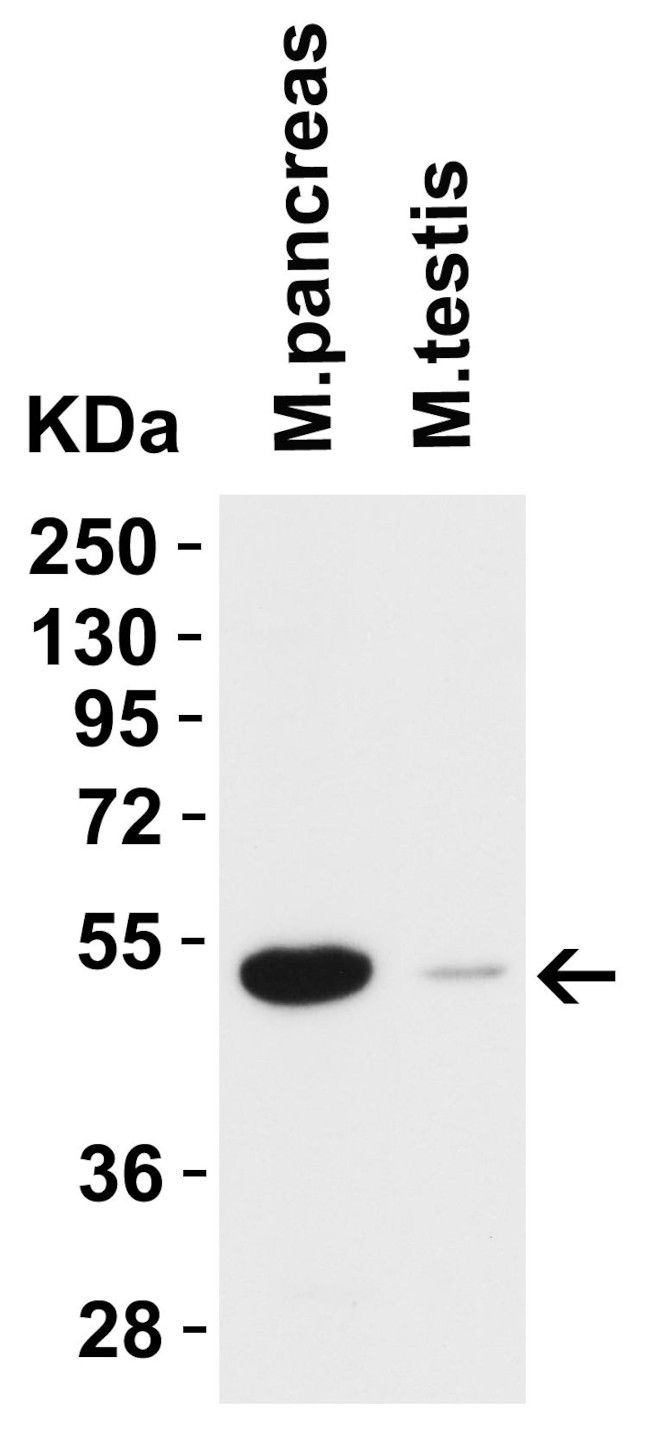 TMPRSS2 Antibody in Western Blot (WB)