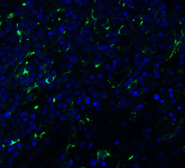 TMPRSS2 Antibody in Immunohistochemistry (PFA fixed) (IHC (PFA))