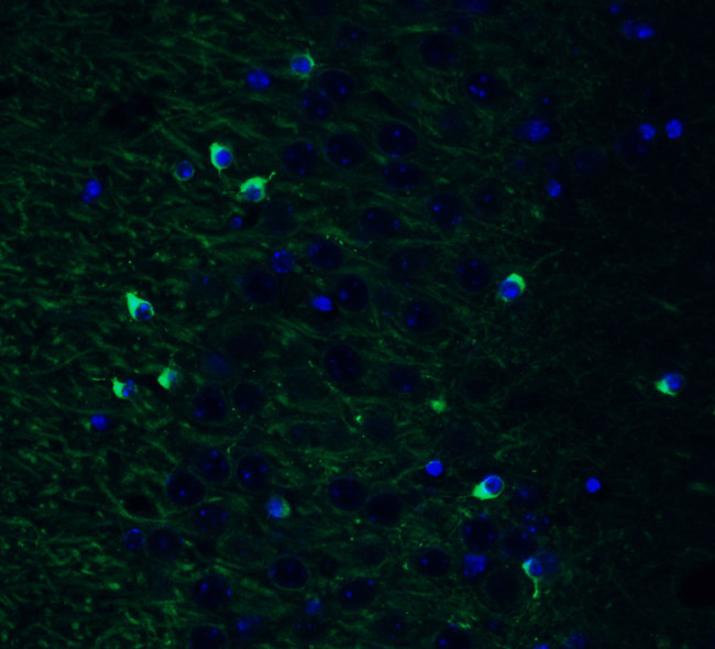 TMPRSS2 Antibody in Immunohistochemistry (PFA fixed) (IHC (PFA))