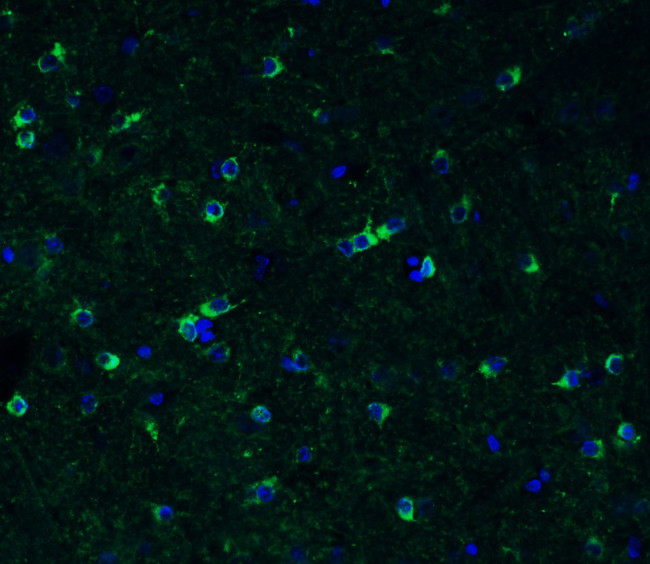 TMPRSS2 Antibody in Immunohistochemistry (PFA fixed) (IHC (PFA))