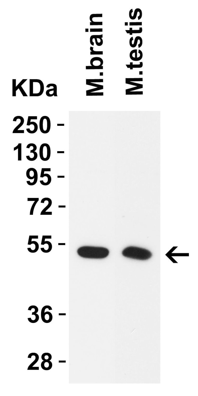 TMPRSS2 Antibody in Western Blot (WB)