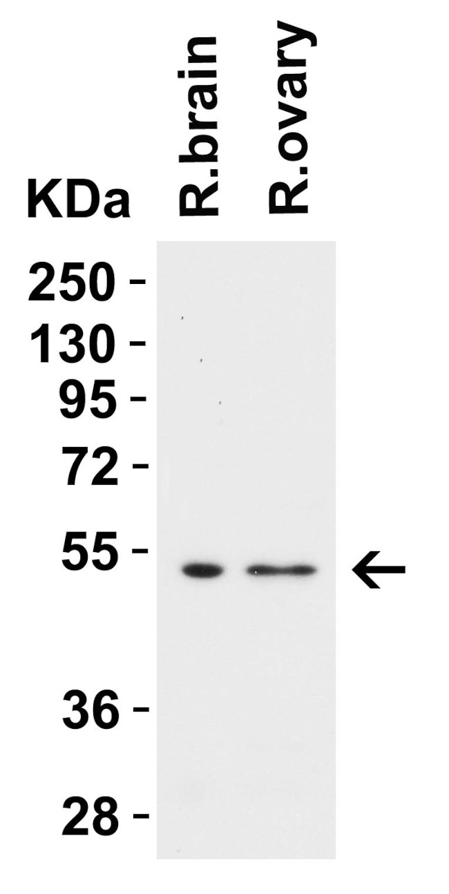 TMPRSS2 Antibody in Western Blot (WB)