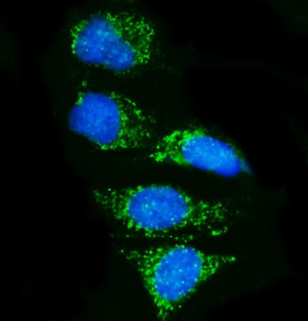 MEFV Antibody in Immunocytochemistry (ICC/IF)