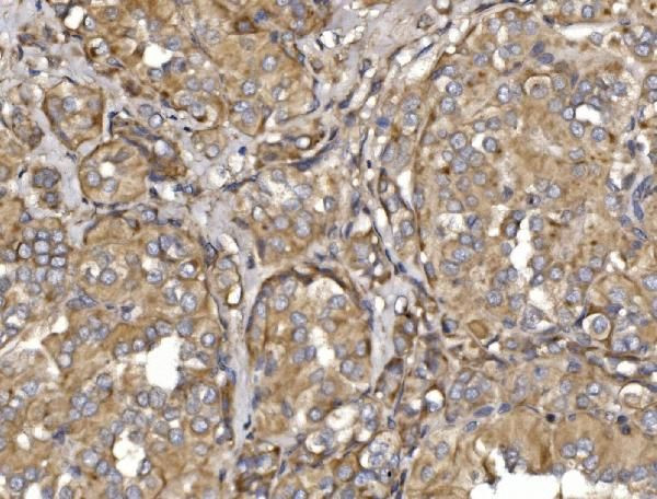 MEFV Antibody in Immunohistochemistry (Paraffin) (IHC (P))