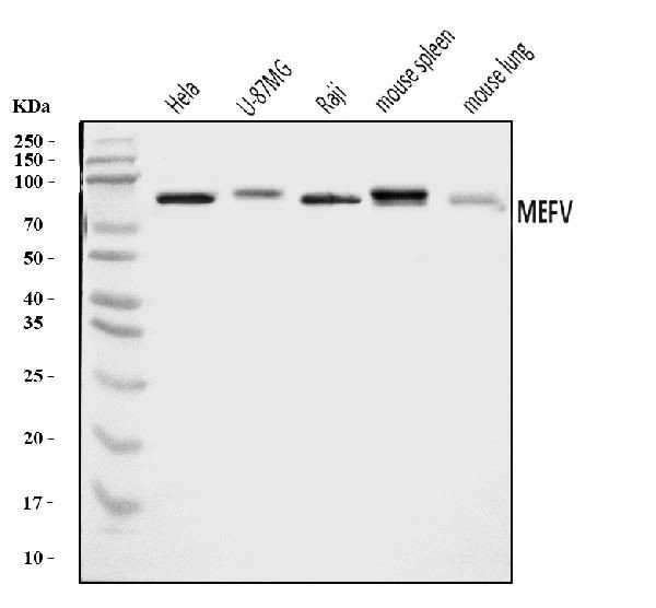 MEFV Antibody in Western Blot (WB)