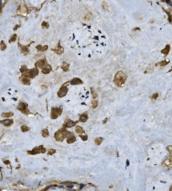 Fibrinogen alpha chain Antibody in Immunohistochemistry (Paraffin) (IHC (P))