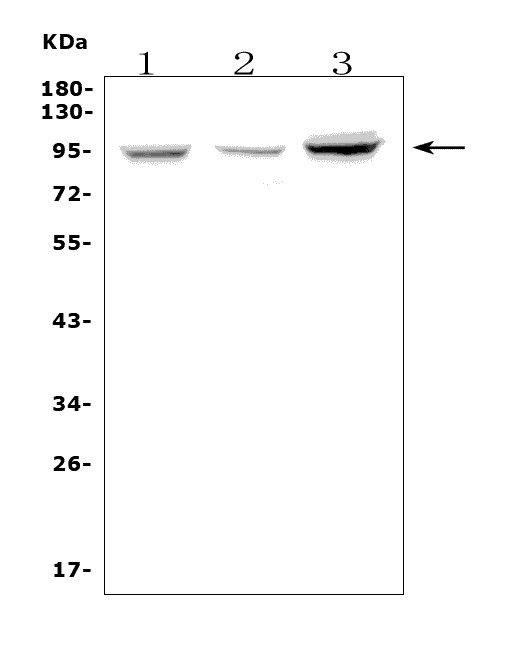 Fibrinogen alpha chain Antibody in Western Blot (WB)