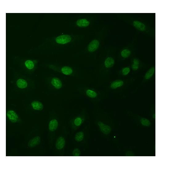 NPR1 Antibody in Immunocytochemistry (ICC/IF)